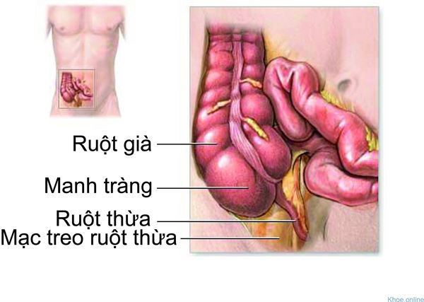 đau bụng dưới bên trái